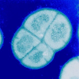 MicroTalks - Conferències de Microbiologia: Astrobiologia + sistemes de vigilància de pandèmies.