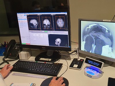 Un minuto de exposición a la luz monocromática modifica las conexiones neuronales